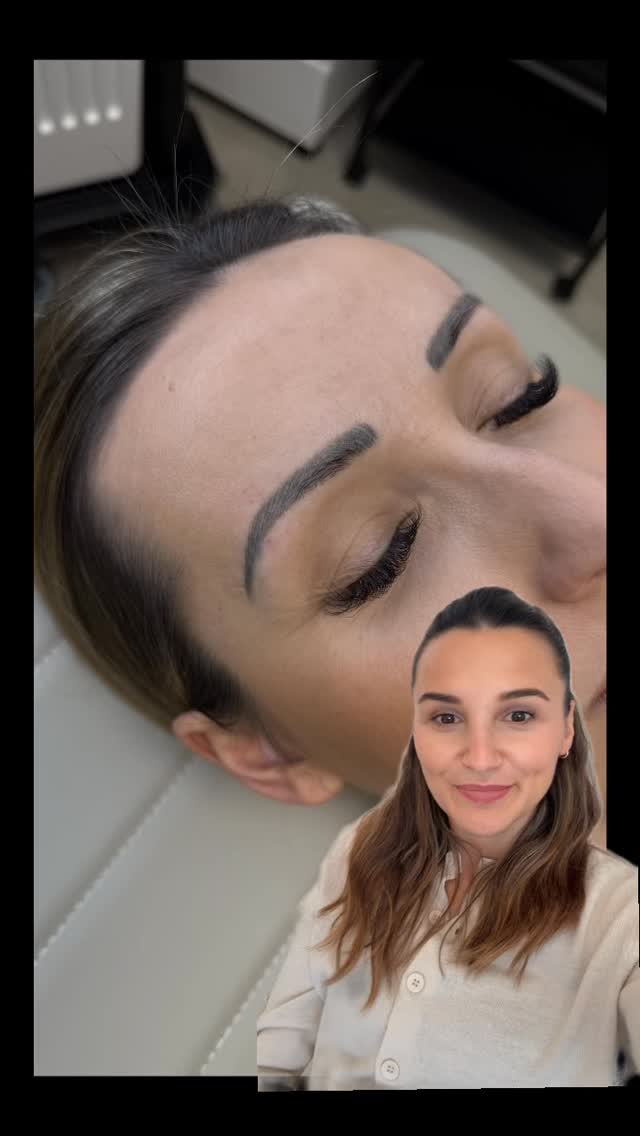 um diese Augenbrauen wieder schön frisch und typgerecht gestalten zu können, muss das alte zuerst weg 🚫
je öfter man es „auffrischen“ lässt mit den selben, falschen Pigmenten, desto mehr Farbe sammelt sich in der Haut. Denn gewisse Pigmente kann der Körper nicht mehr von selbst abbauen, wenn es falsch implantiert worden ist. D.h. auch - es braucht hier einige Entfernungssitzungen um diese ganze - über die Jahre angesammelte - Altlast loszuwerden.
Trust the process, wir werden hier noch super schöne dezente Augenbrauen zaubern 🤩🤗