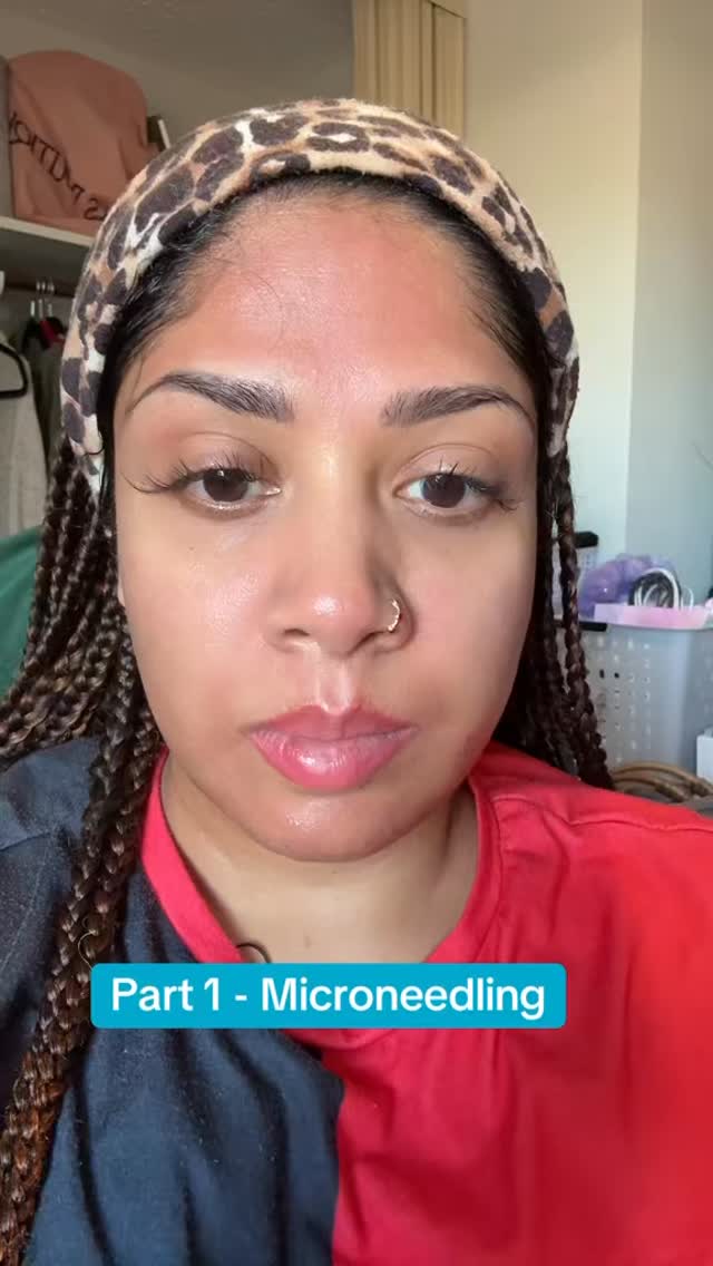 Hey guys! Will be offering micro needling in store starting March 2026! Start booking with me today💕#microneedling #yycskin #clearskin #skinhydration #loveyola