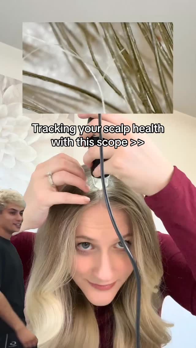 👉 Comment “SCOPE” to try it yourself!
Track your scalp health more accurately, and have fun while doing it!
🔎 Dry flakes, dandruff, excess oil, dirt, product buildup, discoloration, hair density, and so much more!
👉 Comment “SCOPE” and I’ll send you the one I mail all my hair loss clients
#scalphealth #scalpscope #scalp #scalpcare #trichology