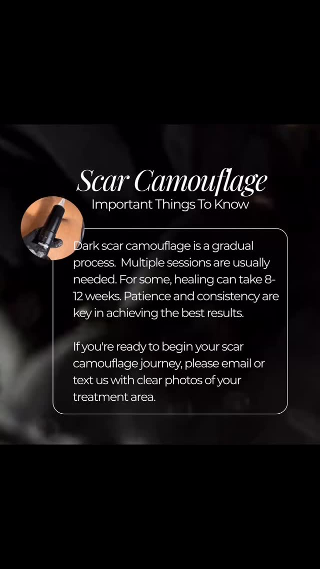 Dark Scar Camouflage is a process that requires 3-4 sessions of neutralizing the hyperpigmentation, scar lightening and color matching to the surrounding skin for undetectable and natural results.
Trusting the healing journey is key! If you have an unwanted dark scar and ready to camouflage it, be sure to contact us or begin your first session today!
Winter session is the opportune time to start your scar camouflage journey and ready for the summer season.
BEATANDBLADE.COM
(832) 377-5677
info@beatandblade.com
“Enhancing Lives One Image At A Time”™️
#scarcamouflage #scar #medicaltattoo #selfcare #love