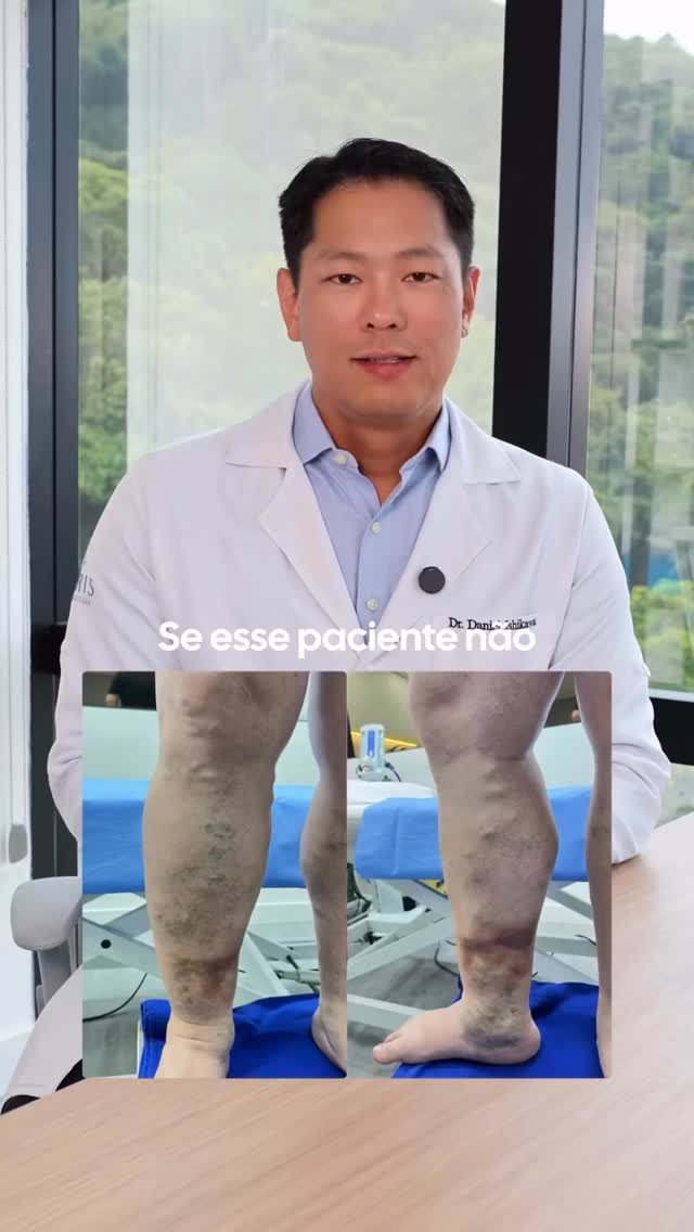 @drdanielvascular
#repost
