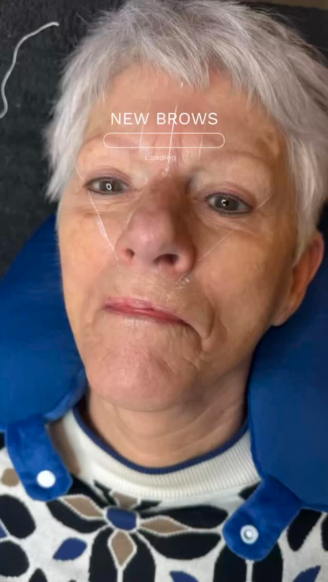 Leeftijd maakt niet uit, mooie wenkbrauwen wel ✨
Powder Brows geven:
🤍 Een frisse uitstraling
🤍 Meer symmetrie in je gezicht
🤍 Altijd verzorgde look
🤍 Zelfvertrouwen zonder make-up
Ready to wake up flawless?
#sdibrows #powderbrows #pmubrows #wenkbrauwen #permanentemakeup powderbrowsnl mooiewenkbrauwen browgoals browstyling natuurlijkeresultaten beautysalon pmunederland selfcare wakeupwithmakeup browtransformation wenkbrauwstyling beautyboost confidenceboost
📍 www.sdibrows.nl
📞 06-31763025