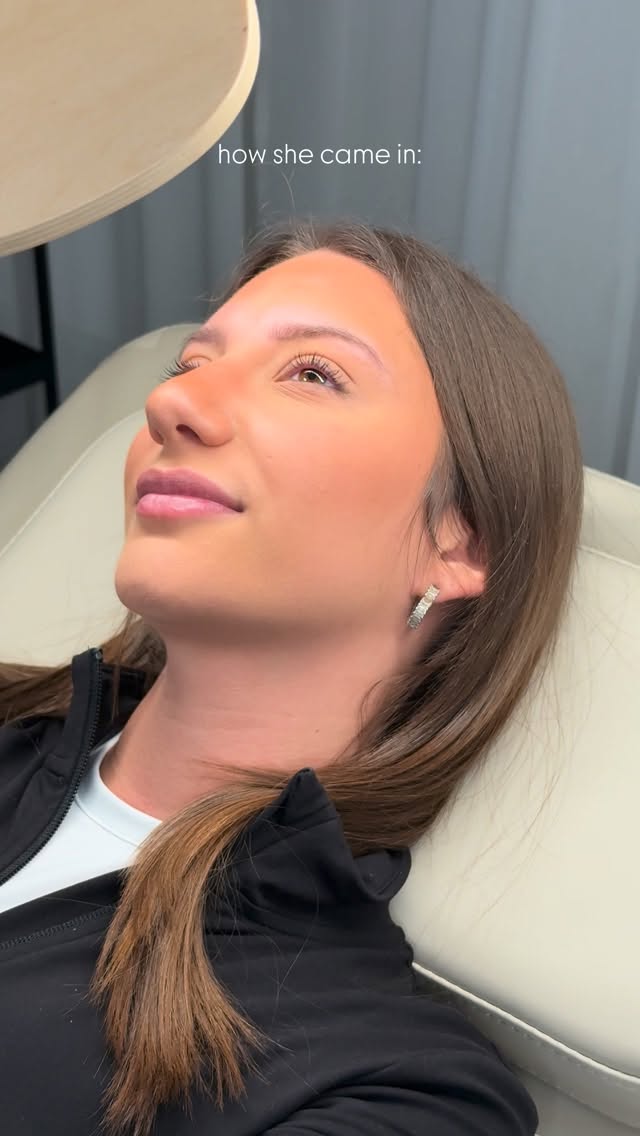 BROWLIFT DELUXE = CONFIDENCE BOOST 🔥
Lerne jetzt, wie du dir ganz einfach ein Browlift Deluxe selbst zaubern kannst - mit unserem BROWLIFT DIY Online Kurs 🤩
www.novafacesmunich.com
#BrowsOnFleek
#HappyBrowsHappyMe #Hairstrokesmünchen #powderbrows #powderbrowsmünchen