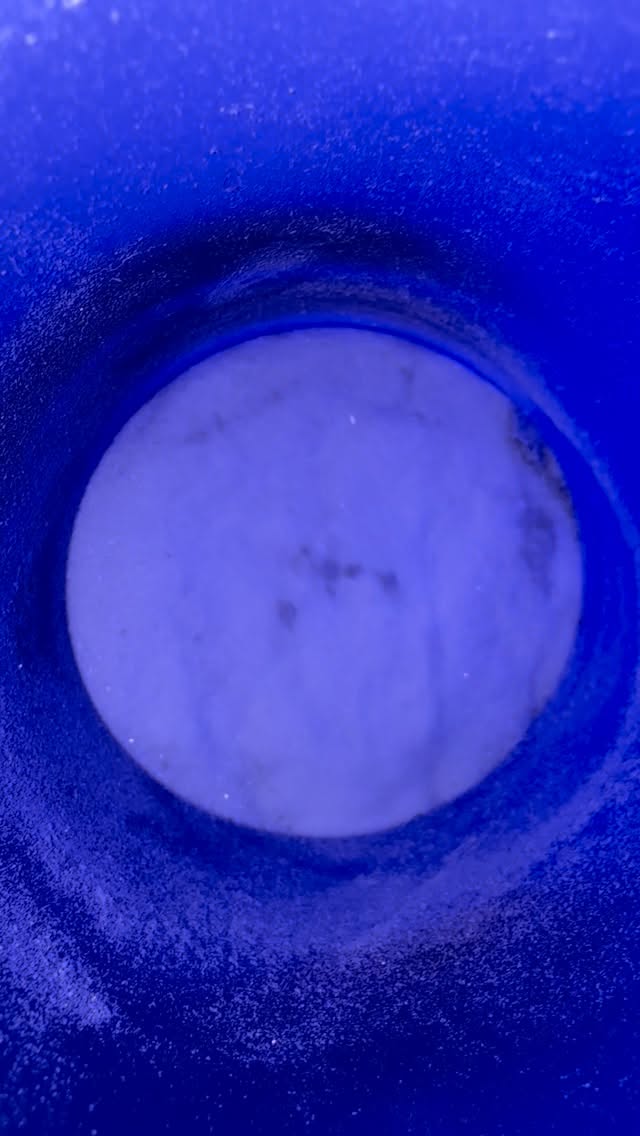 POV: You finally see what’s been sitting on your skin 😍✨
That right there? Dead skin cells, buildup, and congestion that were dulling your glow — now sitting in the Crystal Microdermabrasion disposal compartment.
Crystal microdermabrasion works by physically exfoliating the outermost layer of dead skin while vacuuming away debris, leftover product buildup, and surface congestion. What you’re seeing in that chamber is proof that exfoliation isn’t just a “vibe”… it’s results.
This is why your skin feels smoother.
This is why your makeup sits better.
This is why your glow hits different.
At Luminance Beauty & Body in Roswell, Georgia, we specialize in corrective exfoliation for texture, dullness, acne-prone skin, and hyperpigmentation.
Ready to see what’s hiding on your skin?
Book your Crystal Microdermabrasion today.
#atlantaesthetician #hydrafacial #atlantaspa #microdermabrasion #glowingskin