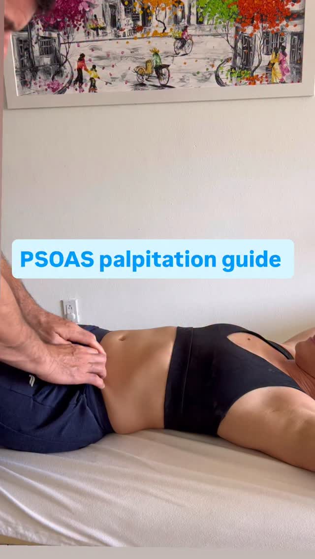 PSOAS: Origin: T12–L5 vertebral bodies & transverse processes
Insertion: Lesser trochanter (via iliopsoas tendon)
Action: Hip flexion, lumbar stabilization
Depth: Deep to rectus abdominis, abdominal viscera, and fascia
Because it lies deep in the abdomen, palpation requires precision and patient relaxation.
⸻
🧍 Patient Position
• Supine
• Head supported
• Knees bent (hook-lying) to slacken abdominal wall
This reduces guarding and makes access easier.
Optional: Slight hip external rotation to reduce abdominal tension.
⸻
🖐️ Practitioner Position
• Stand on the side you’re palpating
• Face patient’s abdomen
• Use relaxed, soft fingers (not poking pressure)
⸻
🔎 Landmarking
Step 1: Identify Surface Landmarks
• Locate ASIS
• Move medially ~1–2 inches
• Identify area just lateral to rectus abdominis
• Target region: Between umbilicus and ASIS
You’re aiming for tissue just medial to the ASIS and lateral to the rectus sheath.
⸻
✋ Palpation Technique (Core Steps)
Step 2: Sink Through the Abdominal Wall
1. Gently press posteriorly toward the table.
2. Move slowly — allow tissues to soften.
3. Avoid sudden pressure (causes guarding).
You are moving through:
• Skin
• Subcutaneous tissue
• Rectus abdominis
• Peritoneal contents
⚠️ Depth is gradual, not forceful.
⸻
Step 3: Ask for Active Hip Flexion
Once you feel you are deep:
“Lift your heel about 1 inch off the table.”
This activates the psoas.
You should feel:
• A firm cylindrical muscle tightening under your fingers
• A subtle medial-to-lateral contraction
• A structure that “pushes” into your fingers
Relax → contract → relax to confirm.
⸻
✅ What You Should Feel
• Deep, vertical muscle belly
• Slight tension change with hip flexion
• Not superficial like rectus
• Not diffuse like intestines
⸻
🚫 Common Mistakes
• Pressing too lateral (you’ll hit iliacus instead)
• Too medial (rectus abdominis)
• Too superior (abdominal contents)
• Too forceful (causes guarding)
• Not bending knees (increases abdominal tone)
#massagetherapy #psoas #psoasrelease #sportsrehabilitation #myofascialrelease