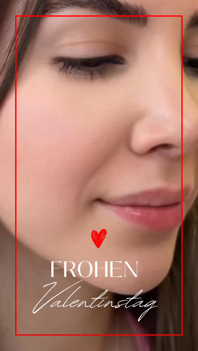 Frohen Valentinstag 💘✨
Heute habe ich wieder gezeigt: Auch nach mehreren „auswärts“ behandelten, leider wenig erfolgreichen Lippenbehandlungen kann man mit einem sauberen Plan und viel Feingefühl Asymmetrien harmonisieren – und zwar natürlich & dezent .
Gerade bei Lippen, die mehrfach vorbehandelt wurden (z. B. unruhige Konturen, „Produktwanderung“, fibrotische Areale) und bei bestehender Asymmetrie, braucht es weniger „mehr Volumen“ – sondern Anatomie, Strategie und Gewebeschonung:
✅ Analyse von Lippe, Philtrum, Cupid’s Bow, Mundwinkeln und Dynamik (Mimik!)
✅ Korrektur statt Überfüllung: Kontur/Projektion nur dort, wo Stabilität da ist
✅ Hyaluron mit passender Rheologie: je nach Ziel eher strukturgebend (höhere Kohäsivität/Elastizität) vs. weich integrierend (mehr Flexibilität)
✅ Mikrodosierung & schichtgerechte Platzierung zur Harmonisierung und für ein natürliches Ergebnis
⚠️ Wichtig: Bei älteren Fillern/Unklarheit kann vor einer Korrektur auch Hyaluronidase sinnvoll sein – individuell nach Befund.
💝 Valentins-Special: 20% auf Lippenbehandlungen
#valentinstag #valentinsspecial #lippunterspritzung #lippencorrection #fillerkorrektur