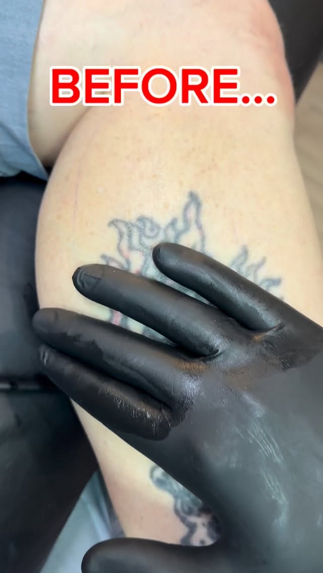 Coverup tattoos are always a challenge but always so much fun.
My customer had this very old and very dark tattoo that he wanted covered. This leg will be a cowboy/ Wild West themed leg sleeve.
Stay tuned for more
#cowboy #coverup #tattoo
@luckysupplyusa @eternalink @truetubes @inkmaster @afterinked @afterinkedcolombia @electricgoldonparkblvd @kingpintattoosupply