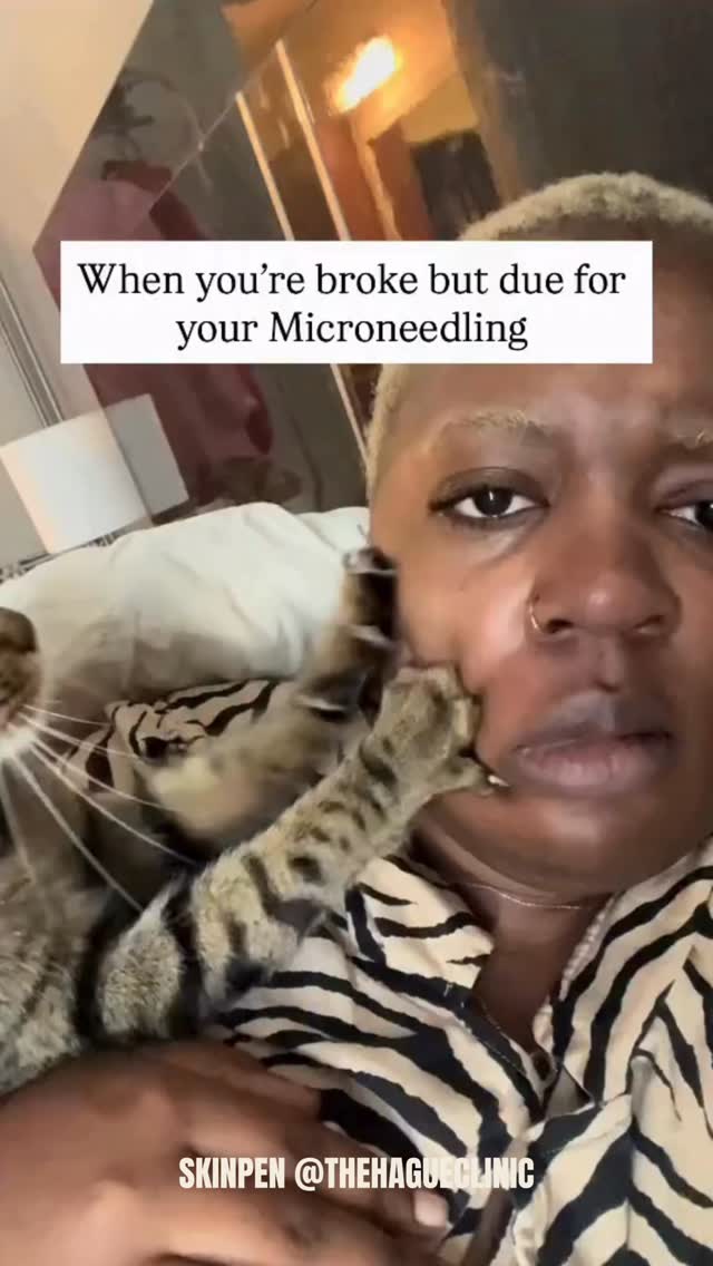 Don’t try this at home 😂
#microneedling #microneedlingthehague #skinpenthehague #skinpennederland #microneedlingdenhaag