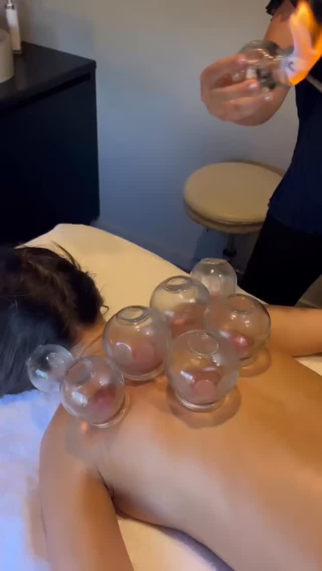 Cupping isn’t just loosening tight muscles. It’s a systemic nervous system signal. 🔥🧠
The suction lifts the skin and fascia and stimulates sensory receptors, sending input up afferent neural pathways to the spinal cord and brain. If your system has been stuck in protect mode from stress, pain history, or chronic inflammation, that strong but safe input can help the brain update the area as safe. That often means less guarding and a calmer baseline.
This is why I use cupping for internal patterns like skin, hormones, digestion, and stress. It can support a shift from fight or flight into rest and digest, where repair, immune balance, and healthy gut and hormone signalling happen.
👉 Cupping also helps move stagnant lymphatic fluid by gently lifting and mobilising the superficial tissues, supporting circulation and natural drainage.
📍Book your cupping session @australianyogaacademy using the website link in my bio
#firecupping #lympathicdrainage #tcmlivingwell #acupuncturist #holistichealth