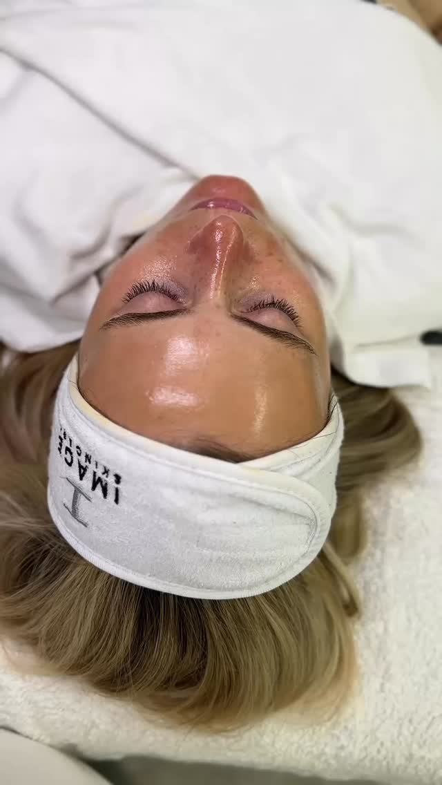 Imagine you wake up on your wedding day with your healthiest skin, all stress free, all you had to do was show up ❤️🔥
There’s a reason why my Beautiful Bride packages have been one of my top bookings for the past 5+ years 😍
Send this to that friend who is getting married and deserves this 👰♀️
(Even better)
Send it to her Husband to be! 😉