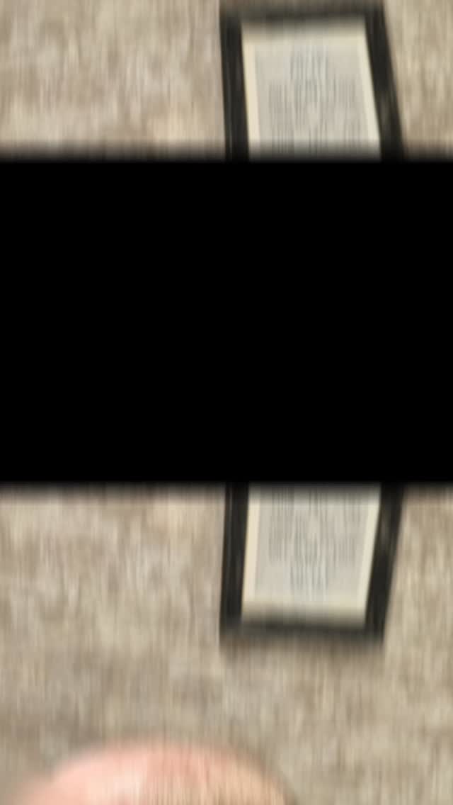 Love this transformation 😍😍😍 #laceintegration #hairlosssolutions #hairbeforeandafter