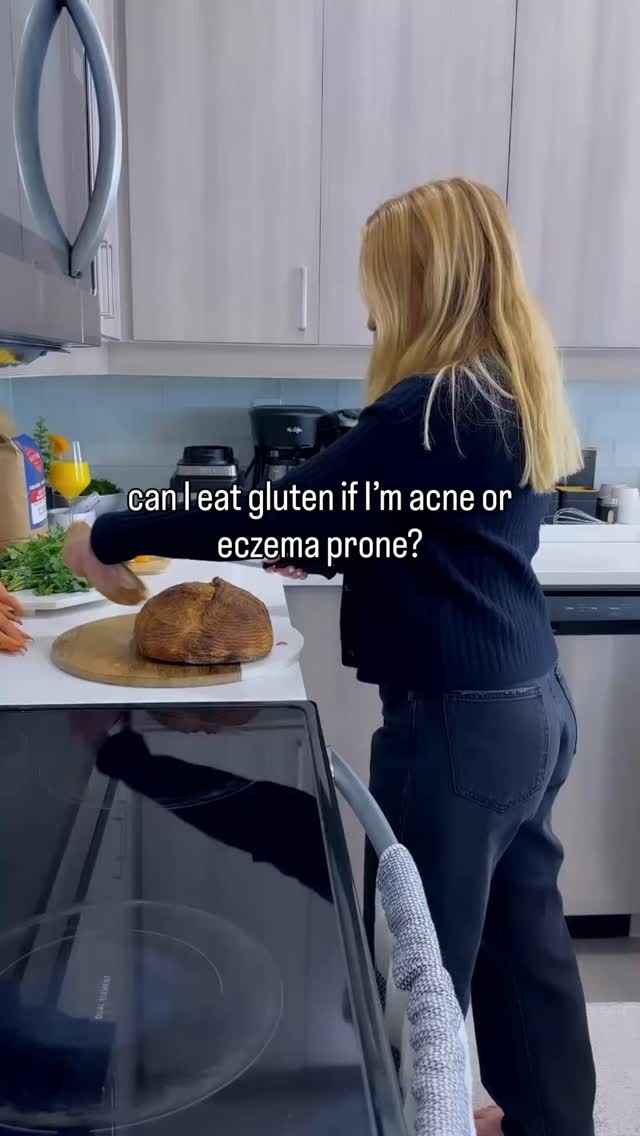Short answer: it depends 🫤
It’s really about what type and how strong your digestion is.
Not all gluten is created equal.
Modern, highly refined wheat:
– Hybridized dwarf varieties
– Sprayed pre-harvest
– Ultra-processed into white flour
– Often paired with seed oils and sugar
That’s very different from:
• Traditional sourdough (long-fermented)
• Organic heritage wheat (einkorn, emmer)
• Properly prepared grains
• Slow-rise breads
Long fermentation partially breaks down gluten and reduces certain gut irritants. Many people with acne / eczema tolerate this far better than conventional bread.
I used to have gluten sensitivity, it would flare my skin like crazy but I was always totally fine with organic sourdough and now I can handle all types of gluten (although I choose not to consume highly refined gluten).
So if your metabolism is low, stress hormones are high, and digestion is weak, even “healthy” gluten can be inflammatory for you.
When thyroid function, stomach acid, and bile flow are strong, the gut lining is more resilient so any gluten is not going to flare you.
However, if your thyroid is struggling in any capacity or your anti gliadin shows up high on your GI map or you are having symptoms after eating “healthy” gluten… it’s wise to avoid gluten entirely while you address the root cause.
This is not a life long sentence. A healthy body should be able to tolerate ALL foods whether you want to eat them or not.
I always say if you have to restrict your diet substantially, you have not cleared your skin permanently.
Should you buy organic gluten? Yes! Always! A lot of sensitivities are actually coming from glyphosate which is an herbicide sprayed to conventional wheat crops. Some acne / eczema prone people can only tolerate organic forms of gluten.
Can you tolerate gluten?
#glutensensitivity #acnefighter #acnetips #eczemarelief #eczemahealing