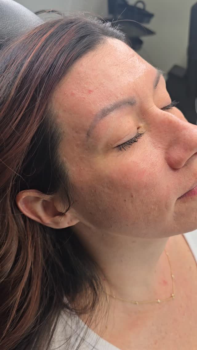 Love fresh powder brows 🖤
Annual refresher after a couple years. It is normal for your brows to fade out, it is normal for some to turn to a cool or warm tone as they fade ... this is why refreshers are needed!
Book your appointment by going to my website in the bio or by texting 843-499-4357.
#powderbrows #permanentmakeup #eyebrows #pmu #charlestonsc