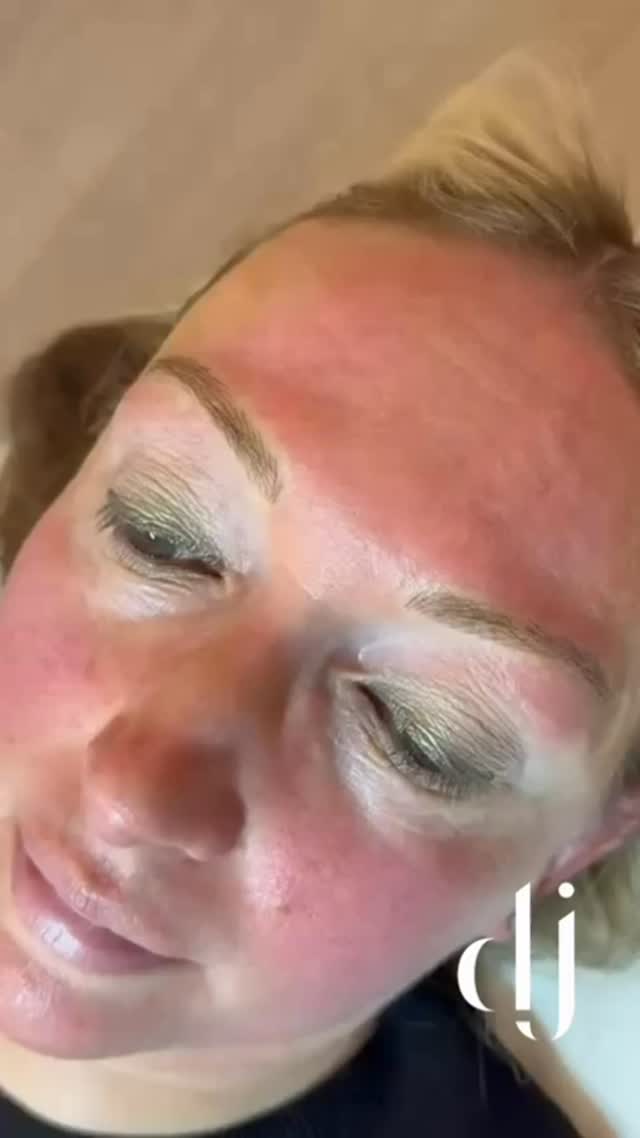 𝐇𝐚𝐢𝐫𝐬𝐭𝐫𝐨𝐤𝐞 𝐁𝐫𝐨𝐰𝐬 𝐏𝐌𝐔. Permanent makeup when its done naturally especially on brows always reframes peoples faces perfectly.
Excepted to last 12-18 months before needing a colour boost
Appointment time 1hr 20mins
Price £250 (excluding top up)
Location - Liverpool
#permanentmakeup #semipermanentmakeup #pmubrows✍🏻️ #microblading #ombrebrows