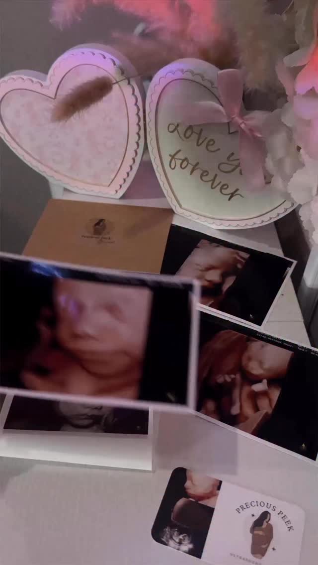 Because sometimes you just want to see your baby 💗
At Precious Peek 5D in Vero Beach, we offer cozy 2D/3D/4D/5D ultrasound experiences designed for connection, reassurance, and precious memories.
See your baby anytime you want in a calm, intimate space serving families from Vero Beach, Port St. Lucie, Melbourne, and the surrounding Treasure Coast.
Reserve your Precious Peek today 💕
Visit PRECIOUSPEEK5D.com to view more & book your appointment 🫶