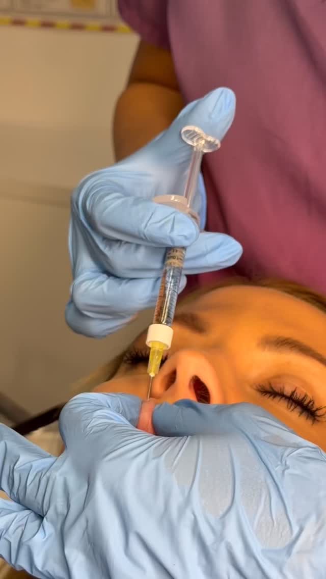 At Evliss Academy, your safety is never optional — it’s the foundation of everything we teach.
Education comes before injection.
Knowledge comes before confidence.
Because responsible practitioners create exceptional results. 💉✨
📩 Contact us to start your journey
📲 Call us at 07526 072 246
🌐 evliss-academy.co.uk
#EvlissAcademy #SafetyFirst #AestheticEducation #MedicalStandards #ResponsiblePractice