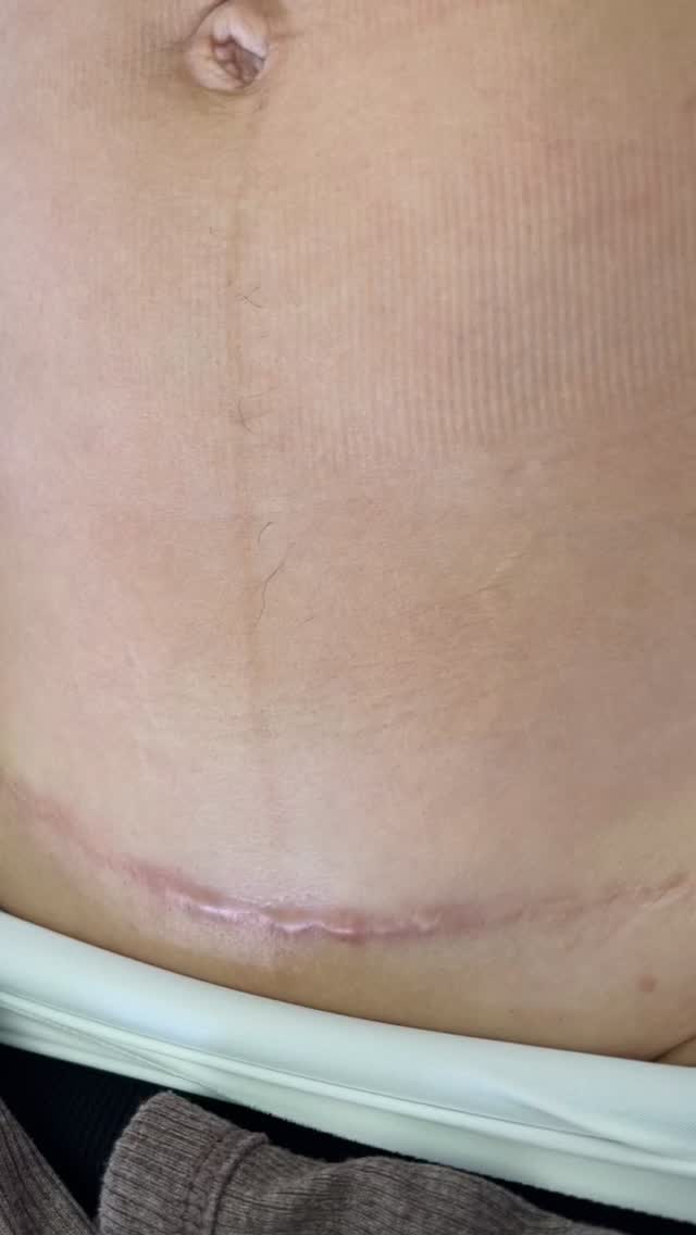 Do you have unwanted scars?
Contact us today so we can assist you with making them undetectable.
Consultations Are Available!
BEATANDBLADE.COM
#beatandblade