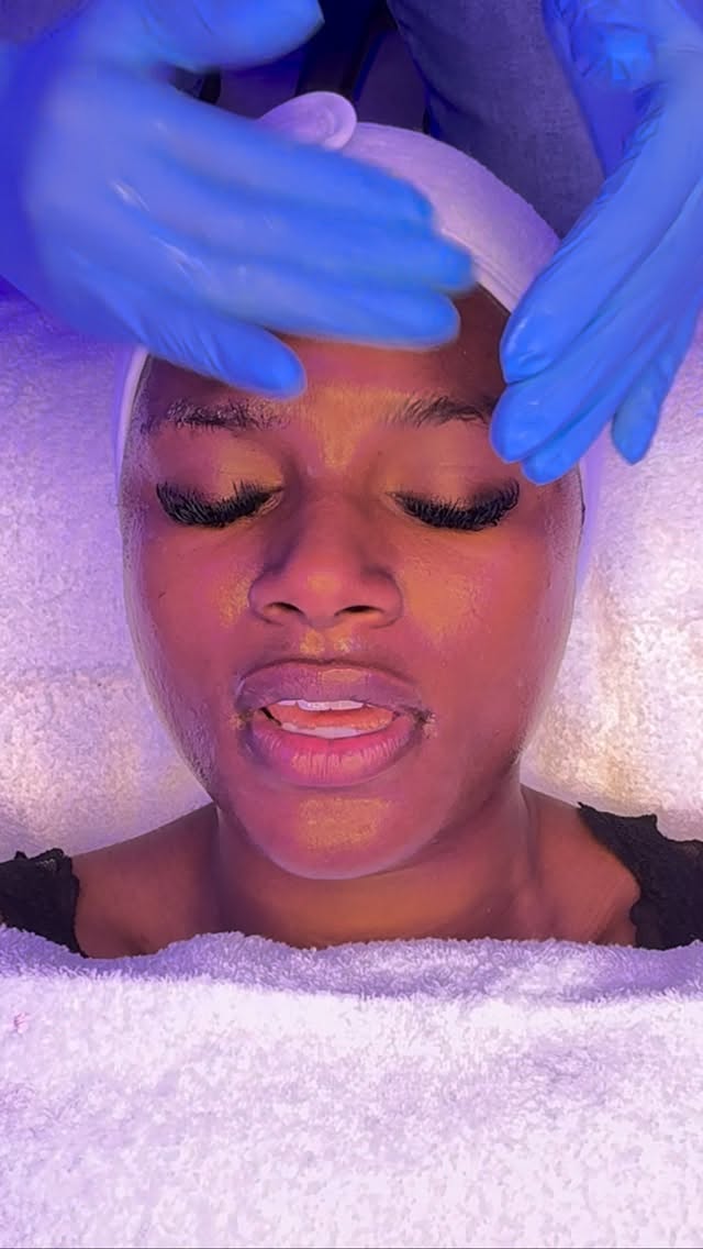 Texture correction. Oil control. Hyperpigmentation correction. ✨
This Crystal HydroDerm Duo is for the client who is serious about resurfacing and refining their skin.
In this step-by-step treatment, we combined crystal microdermabrasion + hydrodermabrasion to:
✔️ Smooth uneven texture
✔️ Decongest pores and reduce excess oil
✔️ Lift dead, dull surface buildup
✔️ Brighten the appearance of dark spots
✔️ Infuse hydration back into freshly resurfaced skin
This is corrective skincare — not just a “relaxing facial.” Every step is intentional. Every product is chosen to support clearer, more even, balanced skin.
If you’re struggling with rough texture, oiliness, acne scarring, or hyperpigmentation, this is your reset treatment.
Ready to resurface and glow the right way? Book your Crystal HydroDerm Duo today. ✨
#atlfacials #atlesthetician #hydrafacial #atlantaspa #hyperpigmentation