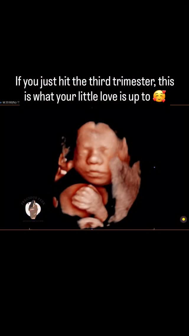 Watching them play with their hands, knowing those same hands will wrap around your finger soon.
It hits different in the third trimester 😍🥰
#pregnancy #pregnant #ultrasound #genderreveal #treasurecoast