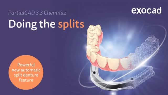 DOING THE SPLITS with exocad! It’s a wonderful day to do the splits with the new PartialCAD 3.3 Chemnitz. Discover our powerful new automatic split denture feature that lets you design an implant-based suprastructure in DentalCAD and generate a precisely fitting underlying bar with just a few clicks in PartialCAD 3.3 Chemnitz. Enjoy advanced visualization tools, superior fit, and effortless customization for next-level results today.
.
PartialCAD 3.3 Chemnitz delivers fantastic new tools to simplify the design process, including a highly automated, guided split denture workflow*!
.
📚 For more information on what exocad can do for you, contact ETI Digital Technology today at 714-238-1490 or sales@etidigitaltechnology.com
#ETIDigitalTechnology #dentaldesign #exocad #partialcad #3.3Chemnitz