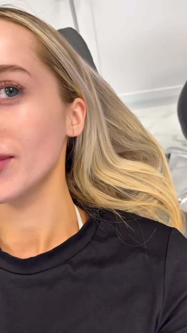 Plump, smooth, and effortlessly natural 💋✨ Because your smile deserves a little extra love.
Call or text today to book your appointment!
☎️ 239-448-3383
📩 chris.jewell@jewellmedicalspa.com
🌐 www.jewellmedicalspa.com | www.mrinjectable.com
📍 1044 Castello Drive, Ste 213 Naples Florida 34103
💳 We Accept Care Credit!
*
*
*
#lipfiller #lipfillers #lipaugmentation #lipplump #lipinjection #lipenhancement
#lipcontouring #restylanelips #injectables #dermalfillers #cosmeticinjectables #aesthetics #beauty #restylane #restylaneusa #naplesbeauty #naplesinjector #medspa #dolllips #lippies #bestaestheticinjectors #beforeandafter