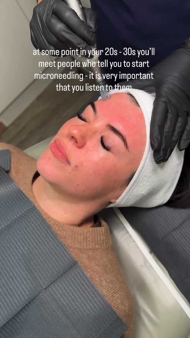 There is no better preventative treatment to slow down the ageing process - I WILL DIE ON THIS HILL 😝
Please make sure you don’t have any holidays in the few weeks after treatment as sun exposure can cause damage following microneedling.
Click on link in bio to book 📆