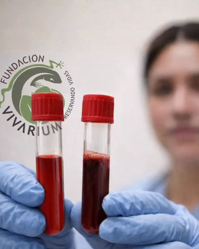 🐍 ¿Cómo se evalúa la gravedad de un envenenamiento por serpiente?
En el accidente ofídico, la severidad se valora combinando dos pilares:
👩⚕️ Clínica: dolor, edema, sangrado, necrosis y otros signos del paciente.
🧪 Paraclínica: pruebas de laboratorio como TP, TTPa y fibrinógeno, que permiten detectar alteraciones de la coagulación. Asi como otros estudios necesarios
Pero surge una pregunta importante:
❓ ¿Qué hacer cuando el laboratorio es costoso, no está disponible de inmediato o los resultados tardan demasiado?
En esos casos existe una herramienta sencilla y muy útil:
🧪 El TCM (Test de Coagulación Manual de 20 minutos ) (20WBCT).
Este método permite detectar alteraciones graves de la coagulación utilizando solo una muestra de sangre en un tubo de vidrio, y puede orientar decisiones clínicas en entornos con recursos limitados.
La preparación y el conocimiento pueden marcar la diferencia. 🐍
Lee la información completa en el blog de nuestra pagina web (link en bio)
fundacionvivarium.org/blog
#AccidenteOfidico #VivariumEduca #Serpientes #Medicina #SaludRural #Antiveneno #EmergenciasMedicas