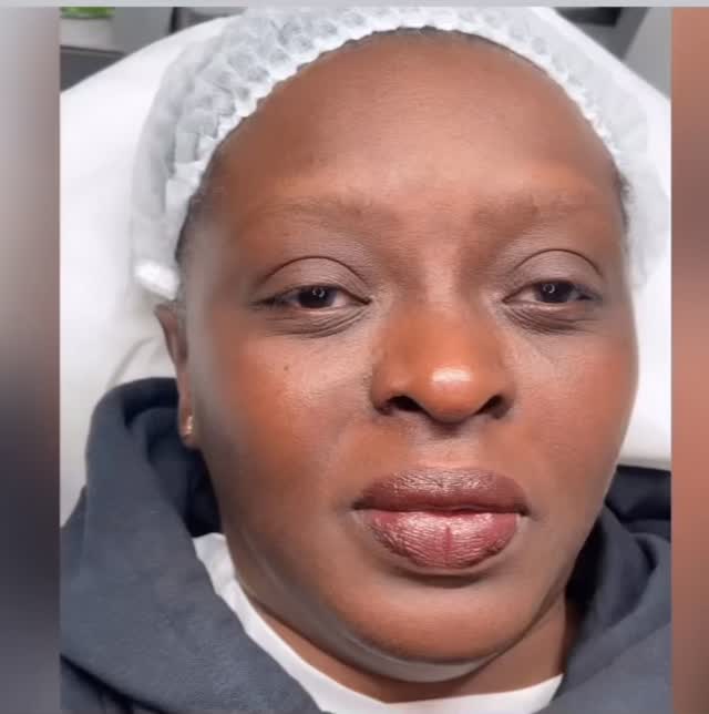 How amazing, such a difference eyebrows makes in the face β€οΈβ€οΈπΈπΈ
Wake up to flawless brows every day.
Soft, natural ombre brows that frame your face beautifully. Effortless mornings. No makeup needed.
Curious how they heal? Results are even better in person.
Book your ombre brow consultation with Naz today. β¨
Naz xx