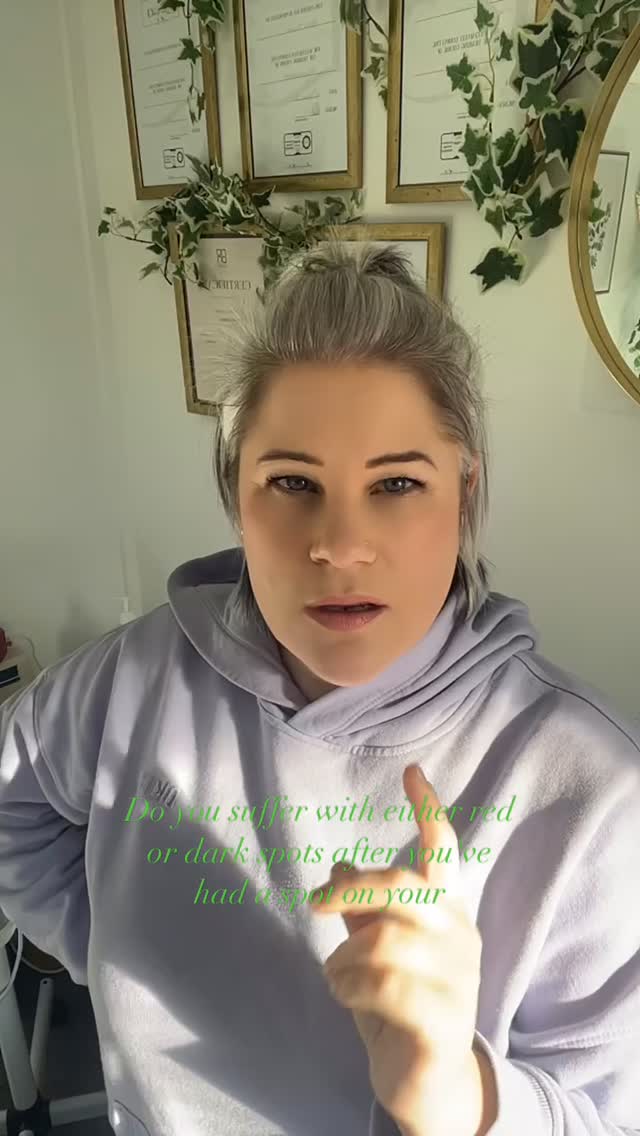 Post inflammatory reactions happen when a person has an inflammatory Reaction within their body
This isn’t exclusive to just spots, it can be from cuts, heat, sun exposure , medication use, generic , endocrine changes( hormones) and more .
Please be aware post inflammatory hyper pigmentation can be caused by incorrect skin treatments !!!!!!!!
There are two levels where the pigment sits in the skin
Dermal and epidermal( deep or more superficial)
It’s a double edge sword because I calm the acne inflammation but many people are already experiencing different shades on their skin. This is due to the neurogenic function in the skin, the cells, certain enzymes being triggers and more /
I have products to prohibit the internal conversion which occurres helping reduce the chance of developing further pigmentation .
Azelaic acid
Alpha arbutin
Cystemamine
Tranexamic acid
Vitamin c are just a few of the ingredients needed
High concentration 20% niacinamide
AND SPF!! NON NEGOTIABLE 🫣 IT IS CRUCIAL
Don’t guess, you will cause more damage than good. Remember the effectiveness of the results comes down to ingredients potency( shop products do not hit the spot needed to actually make changes)
Consistency
Sun protection
Having a tailored skincare plan using noon aesthetics products which I offer here in clinic to avoid further unwanted damage ❤️
DM to start your gentle and effective pigmentation reduction plan now
Book on line - ‼️all new clients need to book in for a consultation prior to any advance treatment ‼️
Anna ❤️
#skinofcolor #hyperpigmentationtreatment #melanin #leightonbuzzard #miltonkeynes