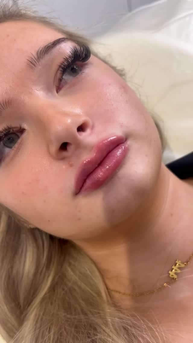 Your perfect lips, just a subtle enhancement away
Lip filler is designed to enhance your natural beauty, giving you soft, balanced, and beautifully defined lips without looking overdone.
✨ Benefits of lip filler:
✔ Adds natural-looking volume
✔ Enhances lip shape and definition
✔ Improves symmetry and balance
✔ Smooths fine lines around the lips
✔ Hydrates and plumps for a softer appearance
The goal is always lips that suit your face perfectly — refined, balanced, and beautifully natural.
📍 Elite Nurse Led Aesthetics – Wakefield
💬 Thinking about lip filler?
Book your consultation today and let’s create your perfect pout 💋
#EliteNurseLedAesthetics
#WakefieldAesthetics
#LipFillerWakefield
#NaturalLipEnhancement
#WakefieldBeautyClinic