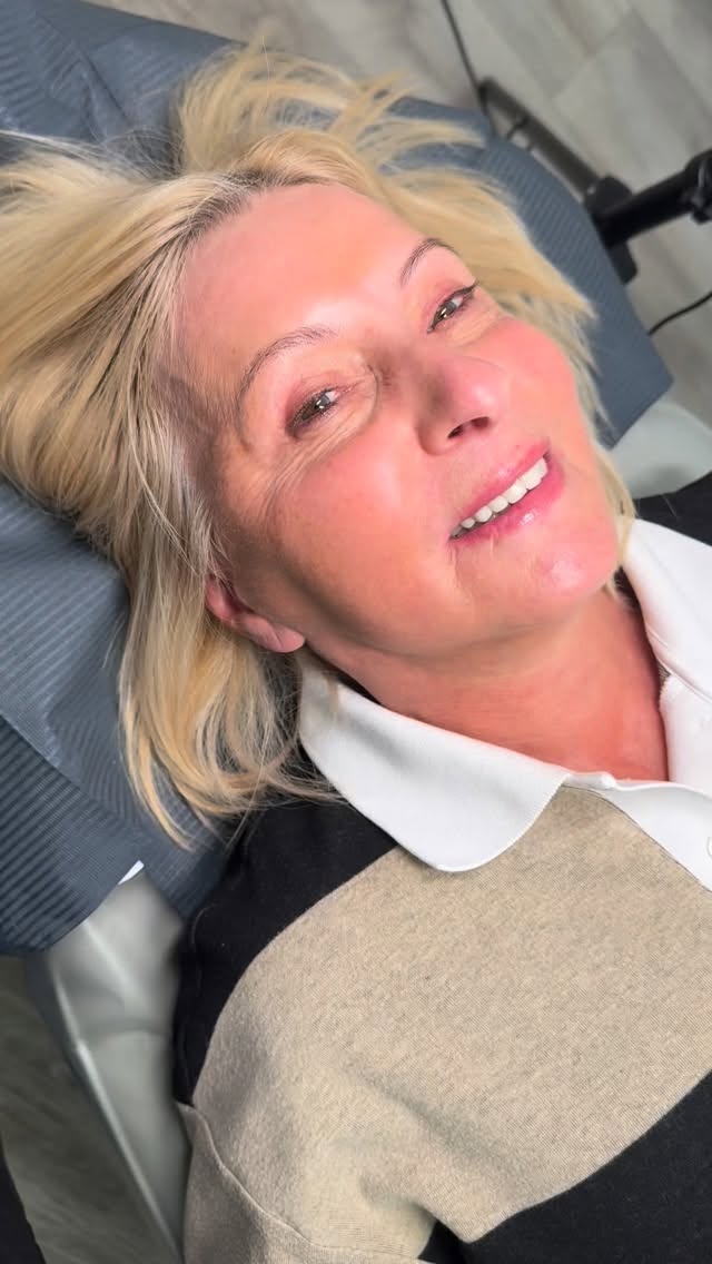 Imagine waking up with perfect nude lips every day?!
Lip blush gives a soft tint that lasts 2–3 years! Some are afraid of the level of pain, but does this beautiful queen look in pain? We use numbing agents to make sure our clients are as comfortable as possible!
Cannot wait to see these healed! 🔥
Shade used: ALMOND NUDE & ROSEWOOD NUDE
By @browdaddy
#lipblush
#lipblushtattoo
#pmureel
#lipblushartist
#westsussex