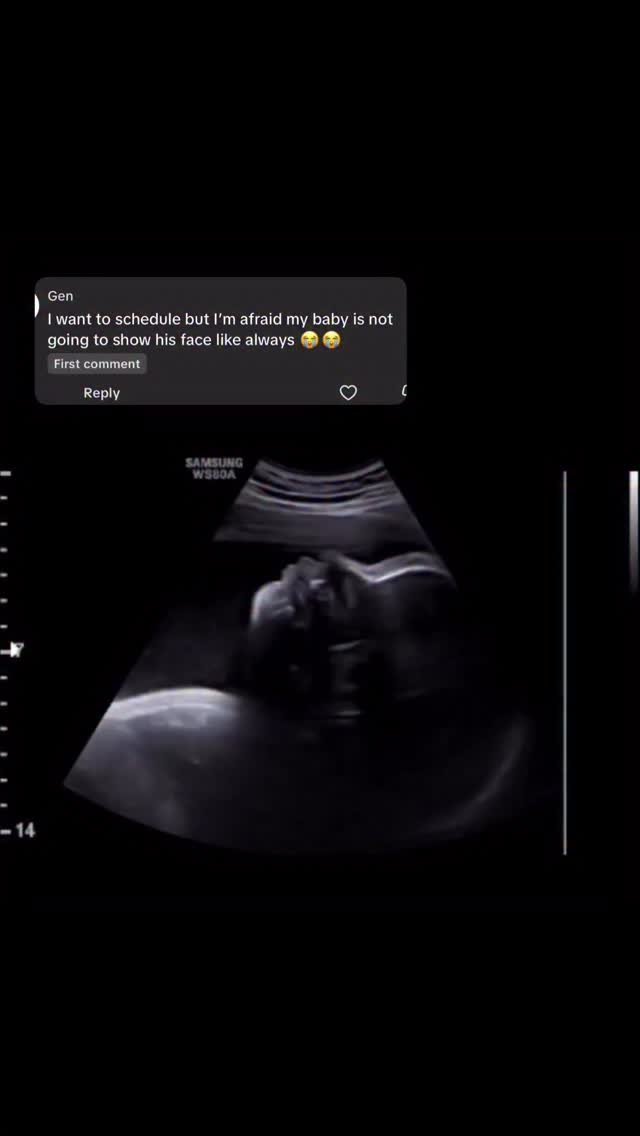 At Precious Peek Ultrasound, we’re exclusively focused on keepsake imaging, this means we take extra time and use special techniques to encourage baby to turn so we can capture those beautiful facial details we’re hoping for!
If baby still decides to be shy, we offer a free rescan on most sessions because baby runs the show and sometimes it just takes another day!
Come see the little face you’ve been dreaming about! Precious Peek will make your experience extra special 🥹🫶