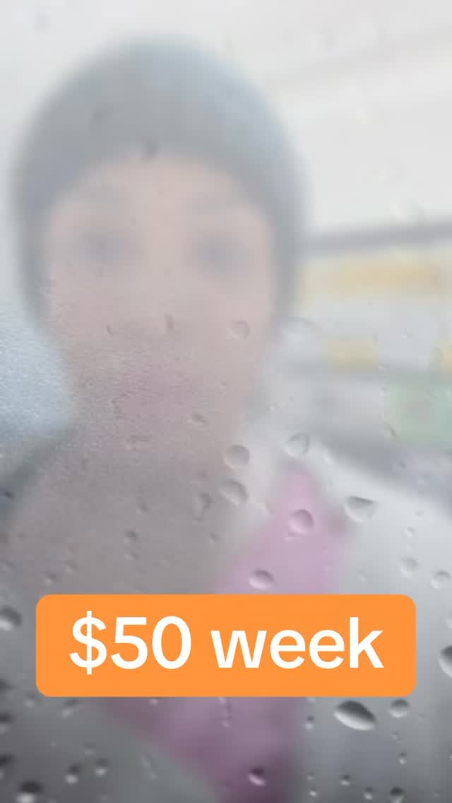 Promotional micro, needling week💕💕💕#skincare #micrneedling #loveyola