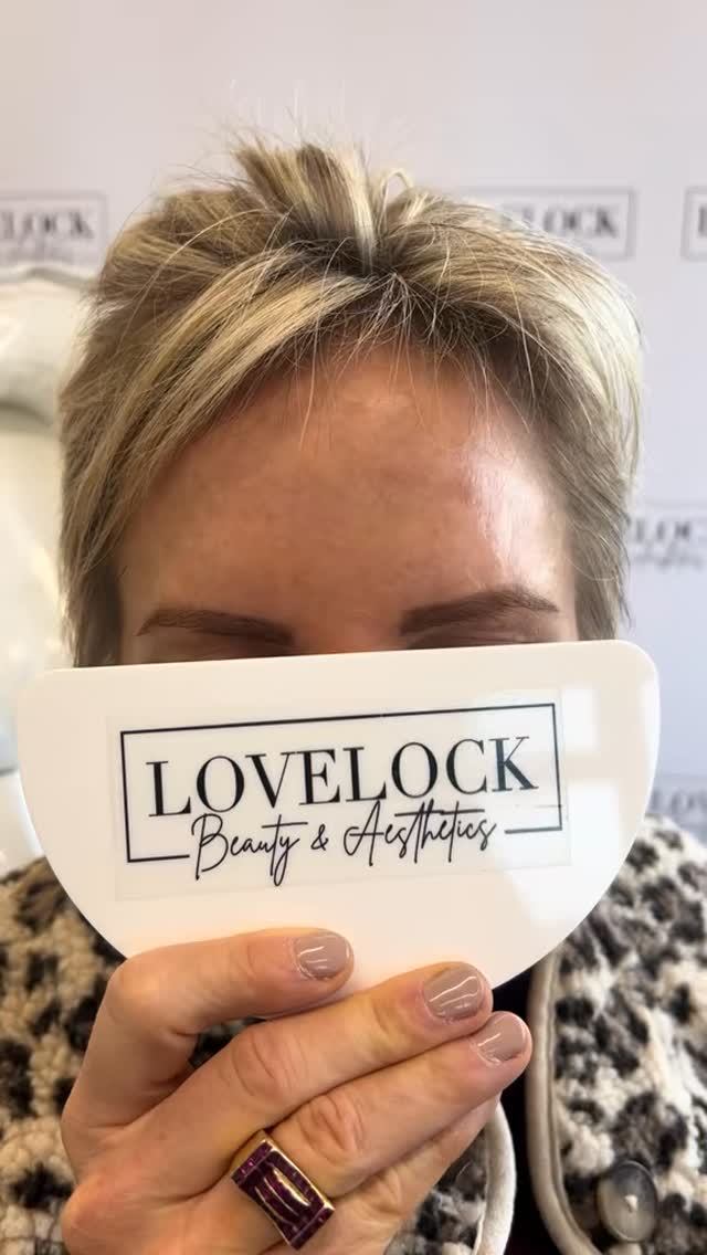 Great results at my clients 2 week review
📍 Warminster 📍 Romsey
Level 7 expert practitioner
#warminster #westbury #trowbridge #frome #melksham