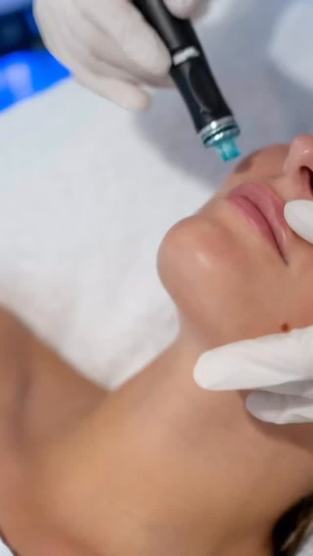 Exciting news! Soon, you will be able to book a HydraFacial treatment at our location in NW80RG💙