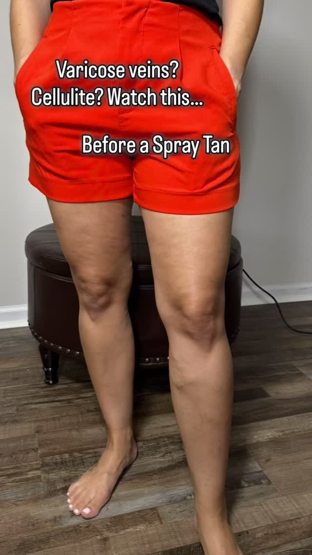 REAL TALK…
A lot of women book spray tans not for a vacation or event…
but because they want their legs to look smoother and more even.
A custom spray tan can help soften the look of:
✨ Varicose veins
✨ Uneven skin tone
✨ Cellulite
It’s not about hiding your skin —
it’s about enhancing it so you feel confident showing it off.
Shorts. Sundresses. Everyday life. ☀️
Would smoother looking legs make you wear shorts more often?
Because confidence shouldn’t be saved for vacations. ✨
Sonoran Glow Sunless Tans 🤎🌵
Mooresville | Lake Norman
DM “GLOW” to book your custom spray tan.
#sonoranglowsunlesstans #spraytan #mooresvillespraytan #lakenormanspraytan #mobilespraytan