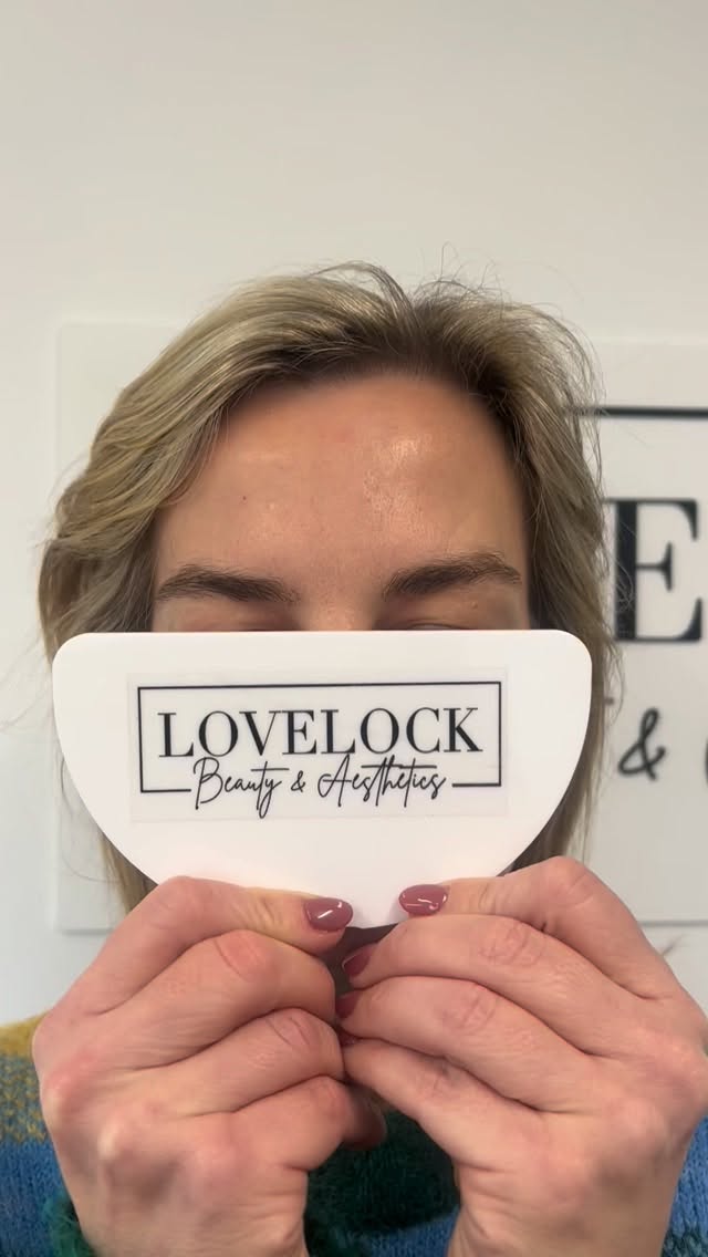 2 week anti-wrinkle review.
Award-winning level 7 expert practitioner 🥇
📍 Romsey 📍 Warminster
#romseylife #romsey #trowbridge #warminster #westbury