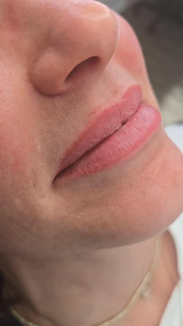 Double annual refresher completed ✨️
Brows and lip blushing all freshened up for the next year to year and a half🤌🏽
Annual refreshers are highly recommended so we can 1. neutralize brows that can turn ashy or warm as the pigment metabolizes 2. Brighten up or change lip color and adjust symmetry on both brows and or lips 3. To keep your pmu looking fresh!
Book your annual refreshers by following link in bio or by texting 843-499-4357
#powderbrows #permanentmakeup #lipblush #SouthCarolina #Charleston