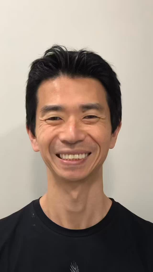 O que o bruxismo pode fazer com o seu sorriso? 🦷⚠️
Texto:
Muitos pacientes me procuram com a mesma queixa: “Doutor, parece que meus dentes estão abrindo ou mudando de lugar”.
Eu senti isso na pele. No meu caso, o bruxismo (o hábito de ranger ou apertar os dentes) estava gerando uma força que “empurrava” meus dentes da frente, abrindo esse espaço que vocês viram no início do vídeo.
Além do prejuízo estético, o acúmulo de comida ali era um problema constante para a saúde da minha gengiva e um grande constrangimento no dia a dia.
No vídeo, mostro como usei a tecnologia 3D para:
1️⃣ Mapear o dano causado pelo bruxismo.
2️⃣ Planejar o fechamento preciso do espaço.
3️⃣ Proteger meus dentes com o uso dos alinhadores.
Hoje, trato meu sorriso com a discrição que eu exijo e a saúde que eu, como Periodontista, não abro mão.
🗓 Quer ver como o seu sorriso pode ser transformado? No dia 18/3 teremos nosso Smileday. 👉 Comente “3D” ou mande uma DM para garantir seu horário de avaliação!