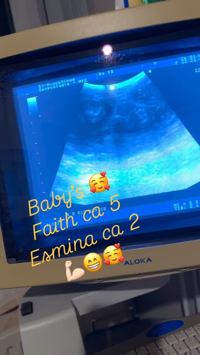 We hebben gisteren even ge-echoot 💪🏻
Zover ik kon zien en tellen heeft Faithje er 5 (golden met bi-mettalic) zo benieuwd hoeveel goldens/bi-matelic’s daar uit komen 🎉😁🫣
Esmina maar 2. Beter iets dan niets 😅 ben al blij dat na dekking nr 4 het eindelijk raak is. Madammetje geen zin in polonaise aan der lijf haha.