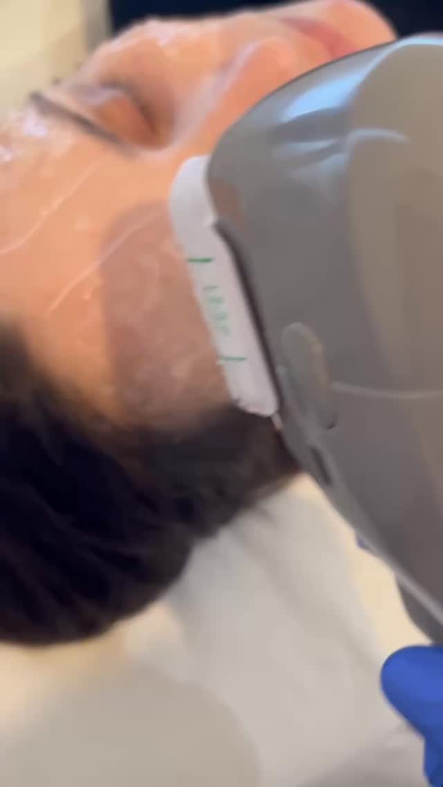 Say goodbye to sagging skin 👋
treatment helps lift, tighten, and rejuvenate your skin naturally by boosting collagen production.
✨ Non-invasive
✨ No downtime
✨ Visible results
DM us to book your HIFU session today!