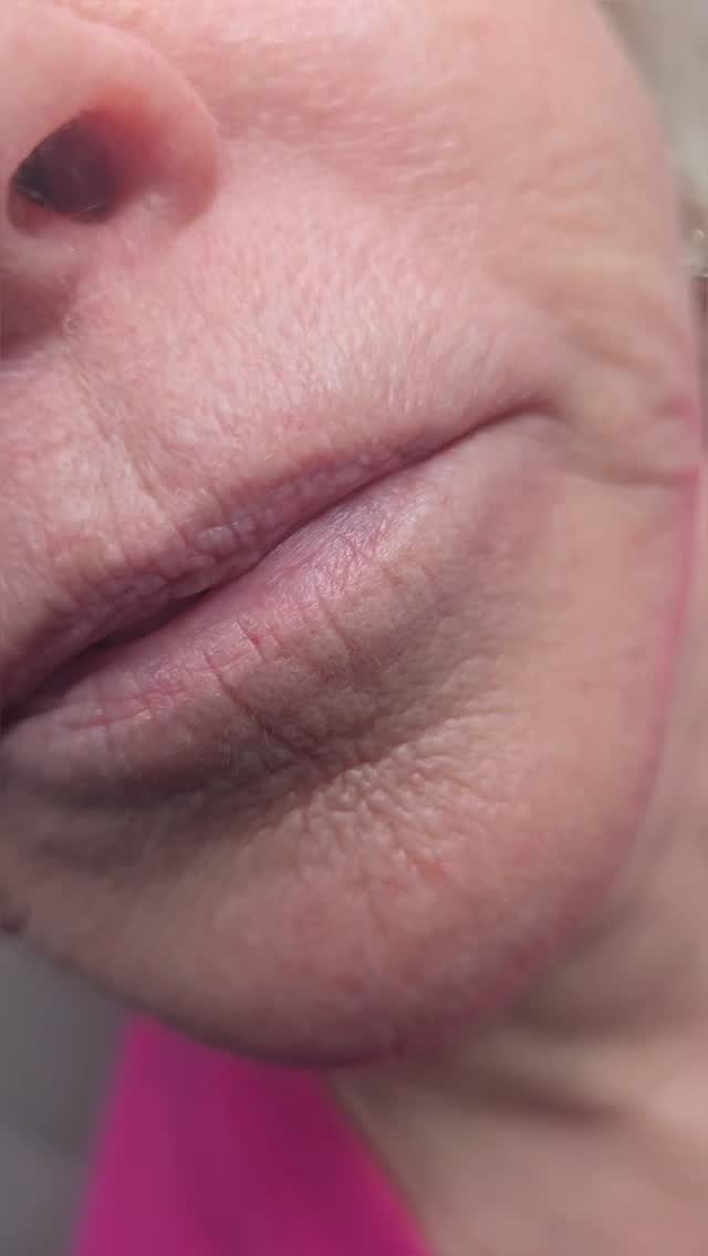 Lip blushing mature lips ✨️
As we age, it's natural to lose that crisp border and vibrant pigment. My goal with Lip Blushing isn't just to add color - it's to restore the definition and youthful "flush"that time takes away.
Working with delicate, mature skin is all about precision. I use a light-handed technique to ensure the pigment heals softly and evenly, giving you a beautiful, "tinted balm" look without the need for daily maintenance.
Book now by clicking link in bio or by texting 843-499-4357!
#LipBlushing #MatureBeauty #PermanentMakeup #CharlestonSC #SouthCarolina