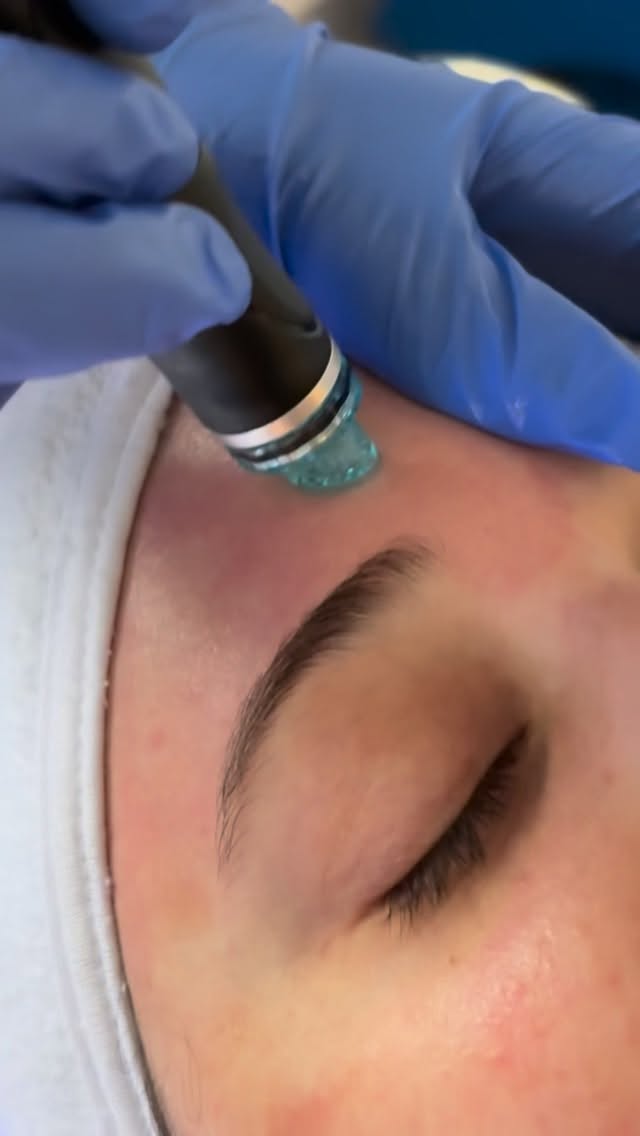 Experience the HydraFacial MD® at View Laser, paired with red light therapy for the ultimate skin reset. This multi-step treatment deeply cleanses, exfoliates, extracts, and hydrates, while red light therapy helps stimulate collagen, reduce inflammation, and support overall skin healing.
The result: smoother, brighter, healthier-looking skin with zero downtime!
📞 Call 604-943-9399
📧 reception@viewlaser.com