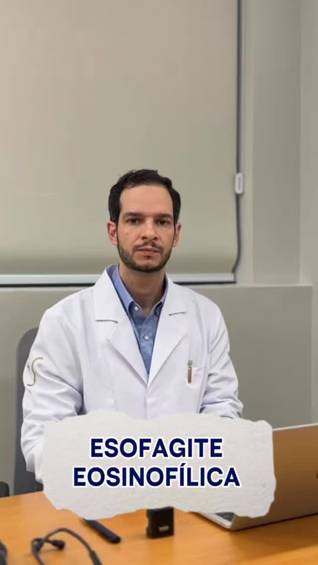 🔥“Azia que não melhora? Pode não ser refluxo ou gastrite
Nem toda azia ou dificuldade para engolir está relacionada apenas ao refluxo gastroesofágico. Em alguns pacientes, especialmente jovens, esses sintomas podem estar ligados à esofagite eosinofílica, uma doença inflamatória crônica do esôfago.
O reconhecimento precoce é importante, pois a doença pode levar ao estreitamento do esôfago e dificuldade progressiva para engolir se não for tratada adequadamente.
Se você apresenta sintomas persistentes ao engolir ou refluxo que não melhora, é importante procurar avaliação médica. O diagnóstico correto permite um tratamento direcionado e melhora significativa da qualidade de vida.
#esofagiteeosinofilica #disfagia #refluxogastroesofagico #azia #drfrancomilan