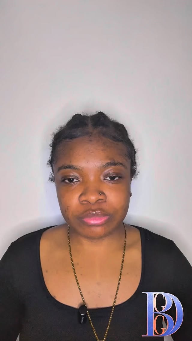 Dark spots don’t mean bad skin — they mean skin that needs patience and understanding.
I know how frustrating it can feel when your skin doesn’t reflect how you feel inside.
That experience is one of the reasons I’m building what I’m building. #bggd #brumgyaliegyaldem #wemakethescene #darkspots #skincare