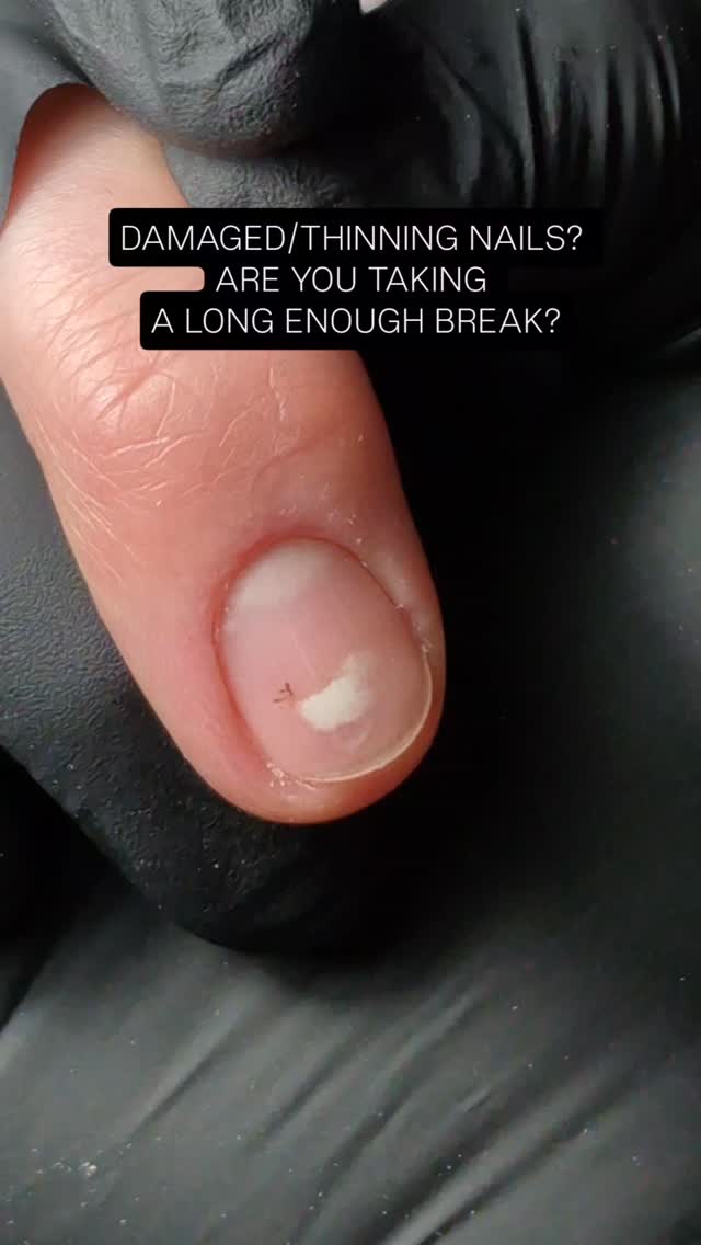 Do you need a break? Four weeks is NOT enough!
The natural nail plate grows about 0.5 - 0.7 mm per week on average. That's roughly 2-3mm per month, meaning it can take 4-6 MONTHS for a nail to fully grow from base to tip.
Therefore, if your goal is to grow out and recover a thinning or damaged nail into a healthier, stronger nail, a substantial break from enhancements may be required.
#nails #naileducation #nailgrowth #nailcoursesdungarvan #nailtips