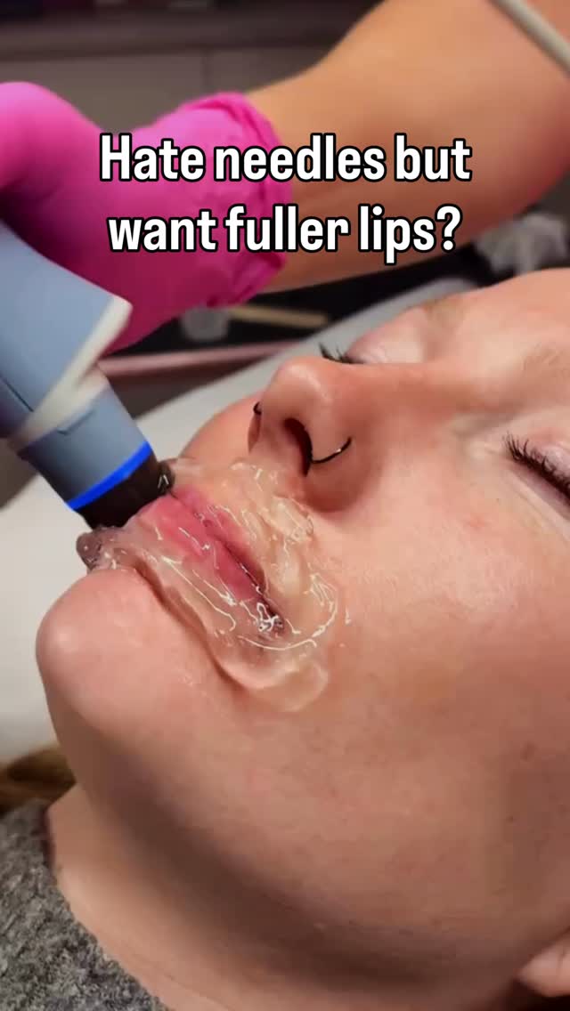 You can get fuller looking lips without needles. 👀
This is our needle-free lip plumper with Exion. It’s for a soft, natural boost if filler isn’t your thing!
————————
✨ Best for: dryness, flat looking lips, lost definition
✨ Expect: subtle plump and smoother looking lips, not a dramatic reshape
————————
Free consults are available in Sherwood Park or book your treatment today!
DM or follow the link in bio
————————
Smooth Secret RN 💋 It’s our Secret
Jo-Lynn Gibbs RN, BScN + Pailey Corbett RN, BScN
#NeedleFreeLipPlumper #SherwoodParkAesthetics #LipTreatmentSherwoodPark