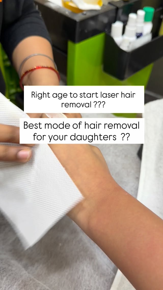 When it comes to hair removal for young girls, the goal is not just “removal.”
It’s comfort, safety, and building healthy body confidence.
In many cases, waxing is a suitable starting option for teenagers.
Why?
• Removes hair from the root → slower, softer regrowth
• Over time, hair may become finer
• Less frequent maintenance compared to shaving
• When done by trained hands, it is hygienic and safe
But what matters more than the method is the mindset 👇
✨ Start only when your daughter feels ready — not because of peer pressure.
✨ If she asks for it, pause and understand her reason before immediately saying no. Sometimes it’s about comfort, not vanity.
✨ Make sure the first experience is gentle and done by an experienced professional.
✨ Teach after-care and hygiene.
✨ Keep the conversation healthy — grooming is personal care, not “fixing flaws.”
Laser hair reduction can be a wonderful long-term option, but ideally when growth patterns are more stable and the child is mature enough to be regular with sessions.
at 16–18 years of age with parental/guardian consent for minors is usually considered ideal .. This is when hormonal changes from puberty have slowed down and hair growth patterns are more settled, leading to better results.
📌 Important Points to Know
• Hormonal maturity matters more than just age: Laser targets hair follicles most effectively once hair growth patterns are stable — often later in teenage years. 
• Parental consent is required for minors: Clinics usually require signed consent and sometimes a parent present for anyone under 18. 
• Effectiveness varies: Teenage hormones can make hair regrow, so younger teens may need more sessions and periodic maintenance. 
• Medical evaluation is helpful: If excessive hair growth is due to hormonal conditions like PCOS, a dermatologist or endocrinologist should be consulted before starting laser removal. 
Hair removal should never come from insecurity.
It should come from comfort and informed choice.
As parents, our role is to guide with understanding — not dismiss feelings.
#drshreyamunjral #skincare #hairremovaltreatment #teenshairremoval