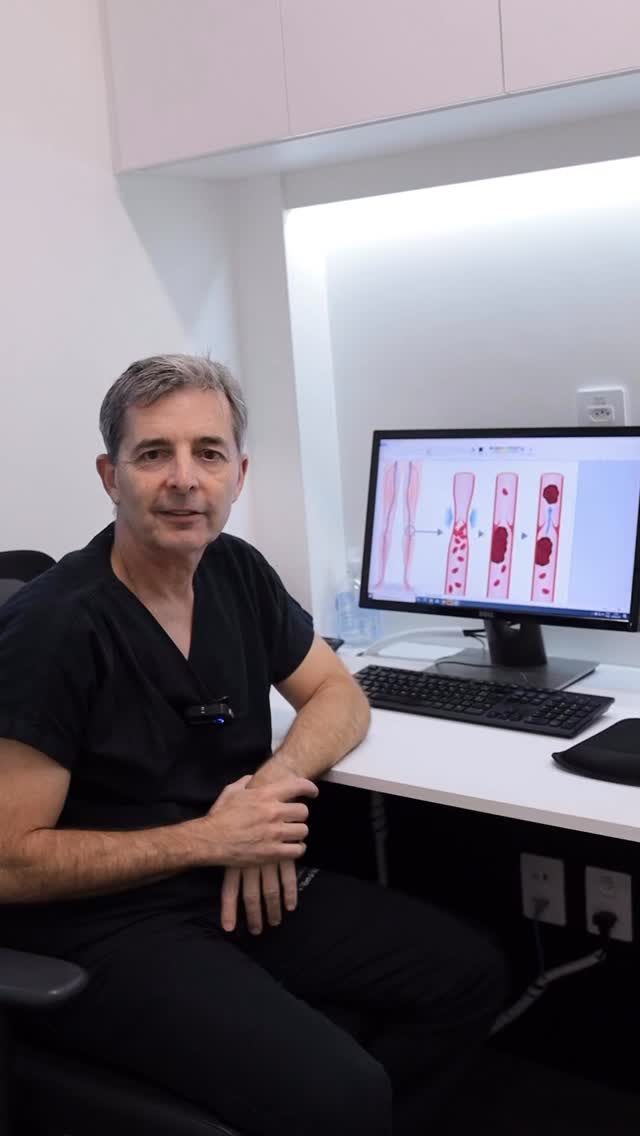 Trombose venosa é a formação de um coágulo dentro de uma veia, geralmente nos membros inferiores. Esse quadro pode ocorrer quando há alterações em três fatores principais do organismo, conhecidos como a tríade de Virchow: mudanças no fluxo sanguíneo, lesão na parede do vaso ou alterações na coagulação do sangue.
No pós-operatório, algumas dessas condições podem acontecer ao mesmo tempo. O paciente pode ficar mais tempo em repouso, o que reduz o fluxo sanguíneo nas pernas, pode haver lesão na parede dos vasos durante o procedimento cirúrgico e, em alguns casos, desidratação ou alterações na coagulação. Esses fatores aumentam o risco de formação de um trombo.
A principal preocupação é quando esse coágulo se desprende da parede da veia e migra pela circulação, podendo chegar aos pulmões e causar uma embolia pulmonar.
Embora a maioria dos pacientes tenha risco baixo de desenvolver trombose após uma cirurgia, é fundamental que exista uma avaliação individual antes do procedimento. A estratificação de risco permite adotar medidas preventivas adequadas.
Entre essas medidas estão a boa hidratação, o uso de medicamentos anticoagulantes quando indicado e a mobilização precoce após a cirurgia, estimulando o movimento das pernas e da panturrilha.
Com planejamento adequado no pré-operatório e acompanhamento cuidadoso durante o procedimento e no pós-operatório, é possível reduzir significativamente o risco de complicações.
Clínica Coris