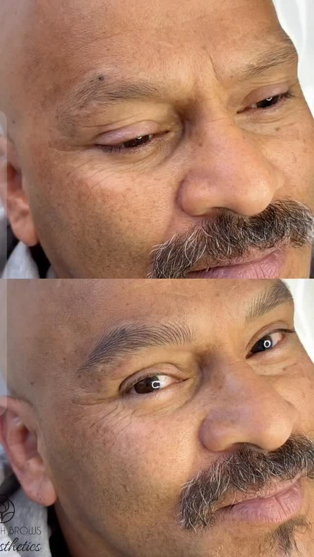 💁♀️Just Done 3 hours tattooing this set of Hairstroke brows that go with his Moustache 🤩💪!!!
This Wellington gentleman met me first time last year in Vietnam during his family holiday! Took him almost a year to decide!😄
His daughter brought him in to support him though the process and As soon as she saw the finished result she said:
“Good! Now we can’t tease you for having no eyebrows anymore, Dad!” 🤭
And Dad?
Absolutely stoked… and finally looking like his moustache has the matching teammates it deserves! 🥸
#mensbrows #eyebrowstattoo #hairstrokeseyebrows #judynguyennz #wellington